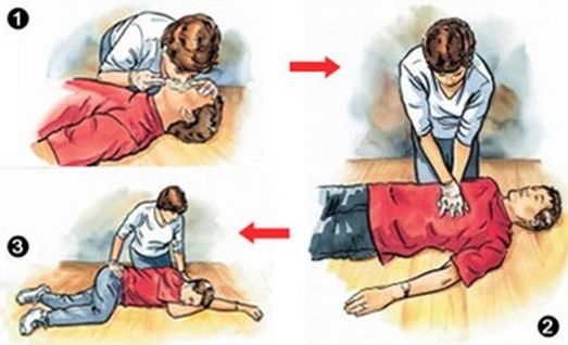 Phương pháp hô hấp nhân tạo sớm nhất trong lịch sử