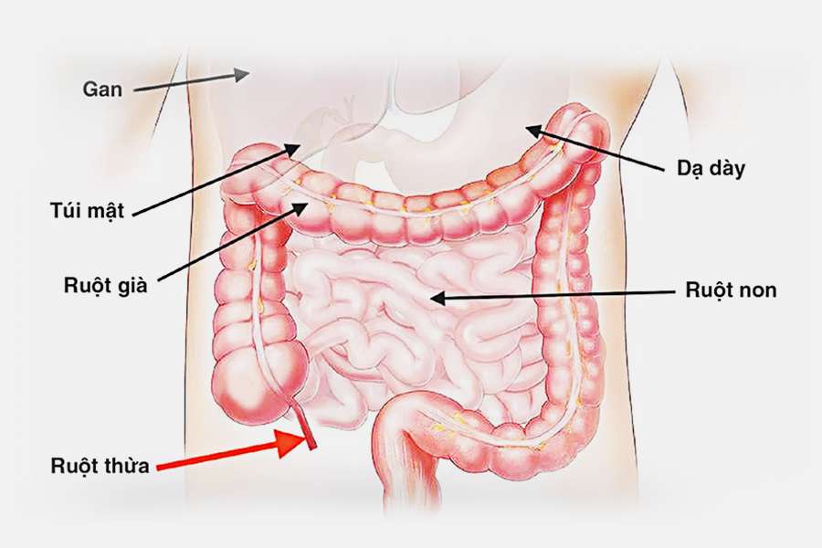 Cận lâm sàng ruột non