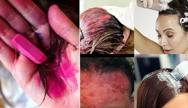 Cẩn thận với thuốc nhuộm tóc