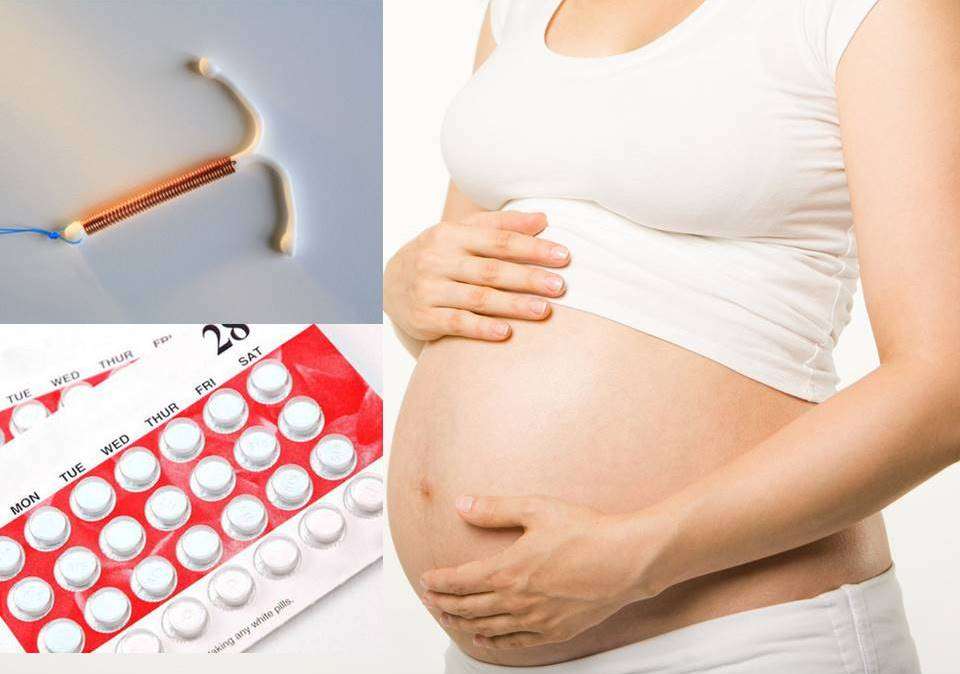 Phương pháp ngừa thai (Birth Control)