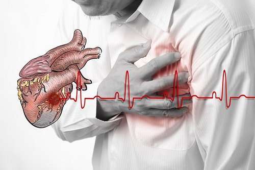 Nguyên nhân gây Thiếu máu cơ tim