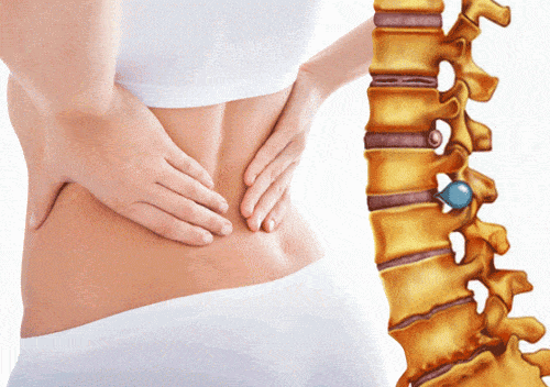 Điều trị thoát vị đĩa đệm hiệu quả