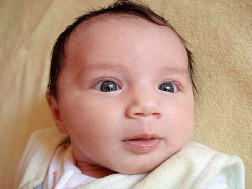 Cẩn trọng khi trẻ bị mắt lác, mắt lệch